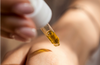 Niacinamide 101: Why This Ingredient Is a Must-Have in Every Skincare Routine